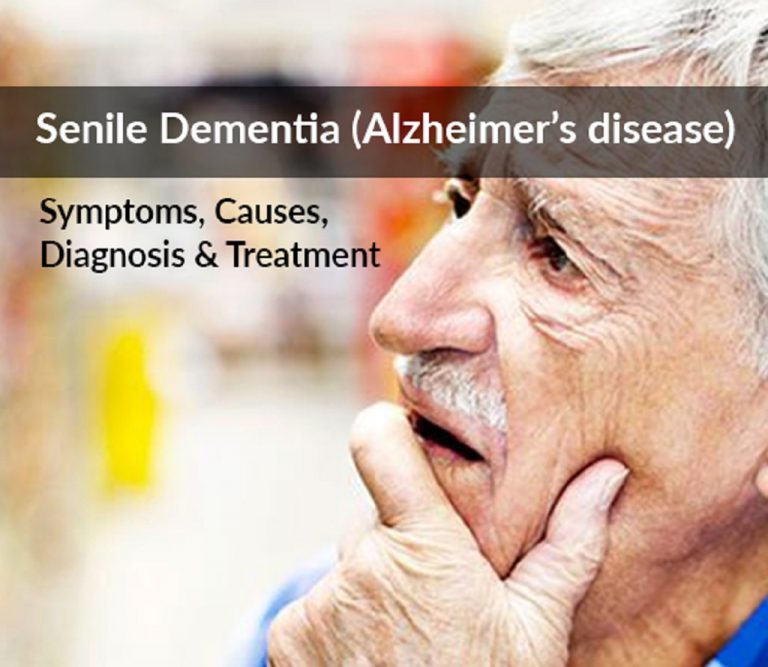 What Are the Senile Diseases that are Getting Younger and Younger, and Do You Pay Enough Attention to Them?